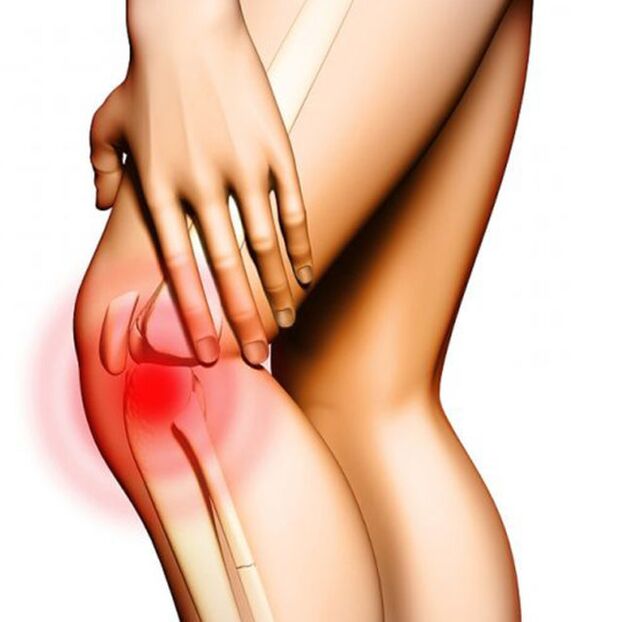 dor no joelho com artrose