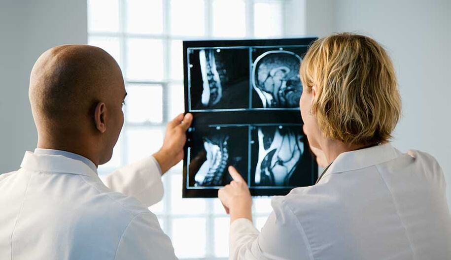 diagnóstico de osteocondrose cervical por imagens