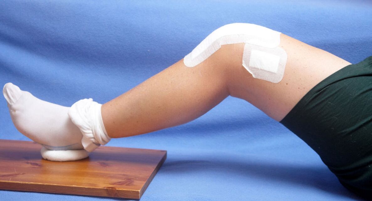 lesão no joelho como causa de artrose