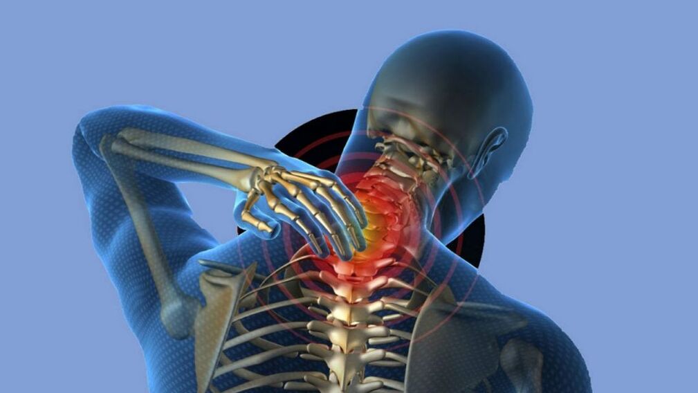 Osteocondrose da região cervical
