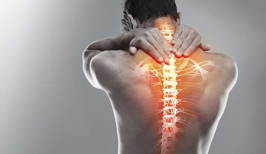 Osteocondrose do pescoço