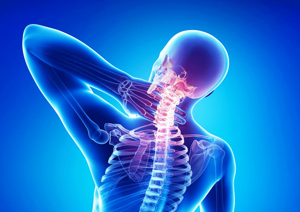 Osteocondrose da coluna