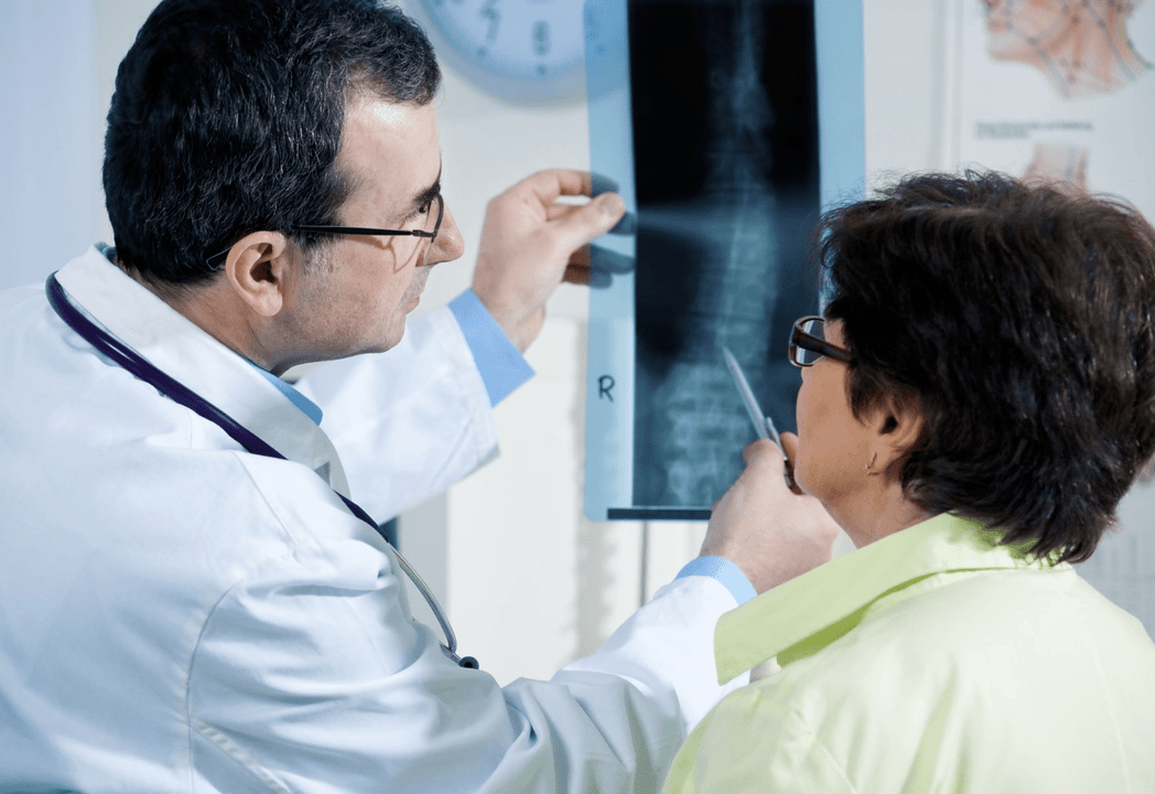 Um neurologista diagnostica osteocondrose usando radiografia da coluna
