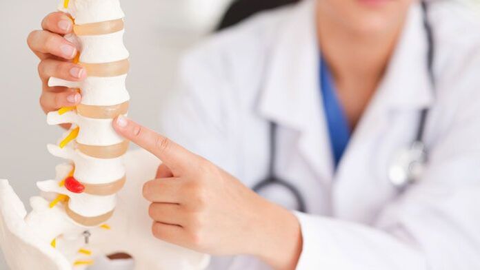 explicação da osteocondrose lombar em um modelo da coluna